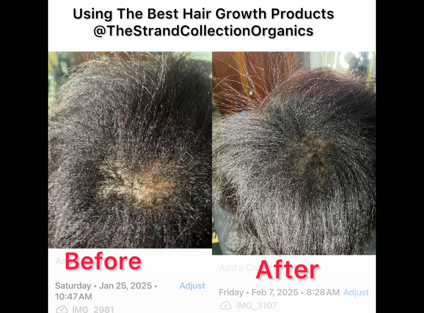 Best Hair Oil with Batana Oil (4oz) image 7