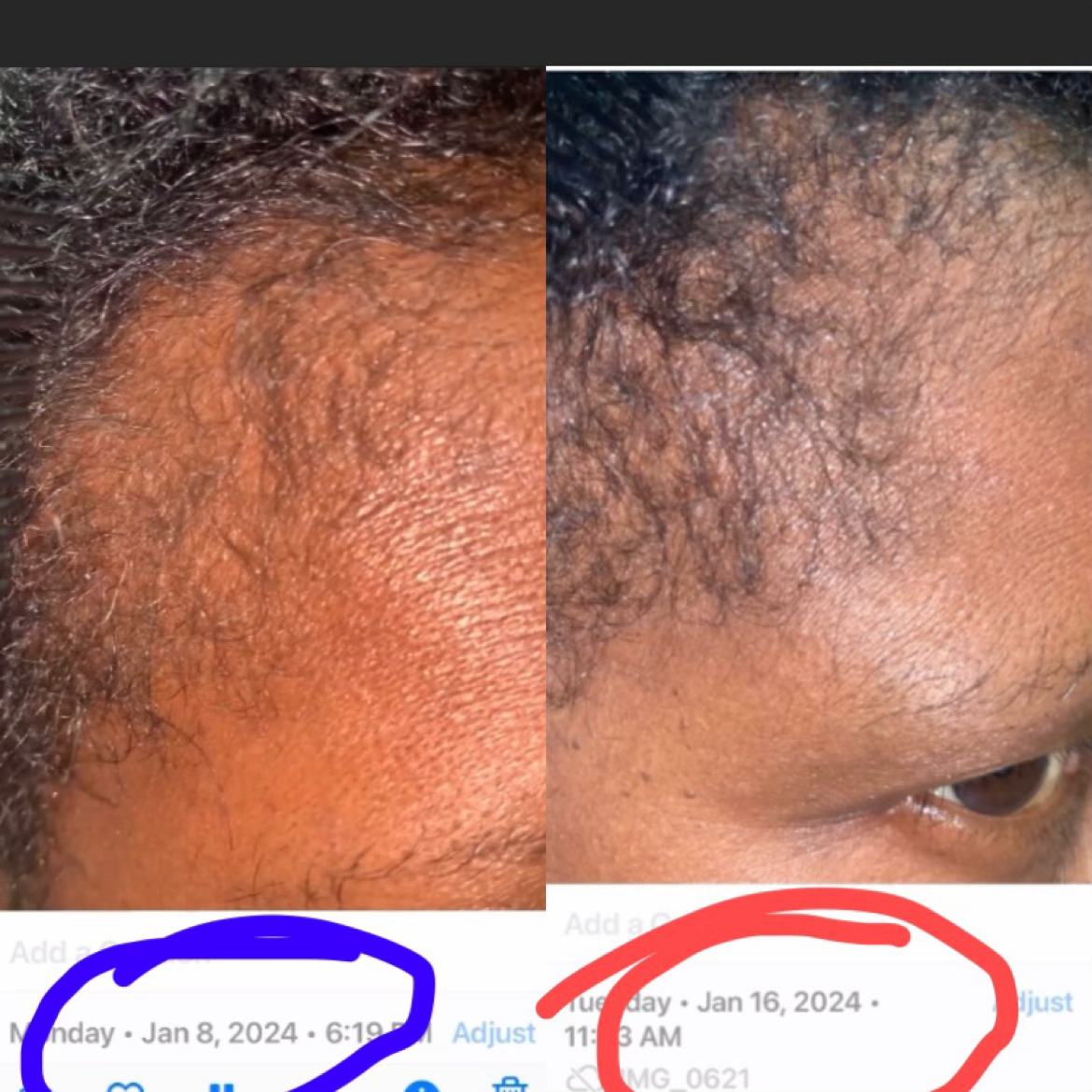 Best Hair Oil with Batana Oil (4oz) image 13