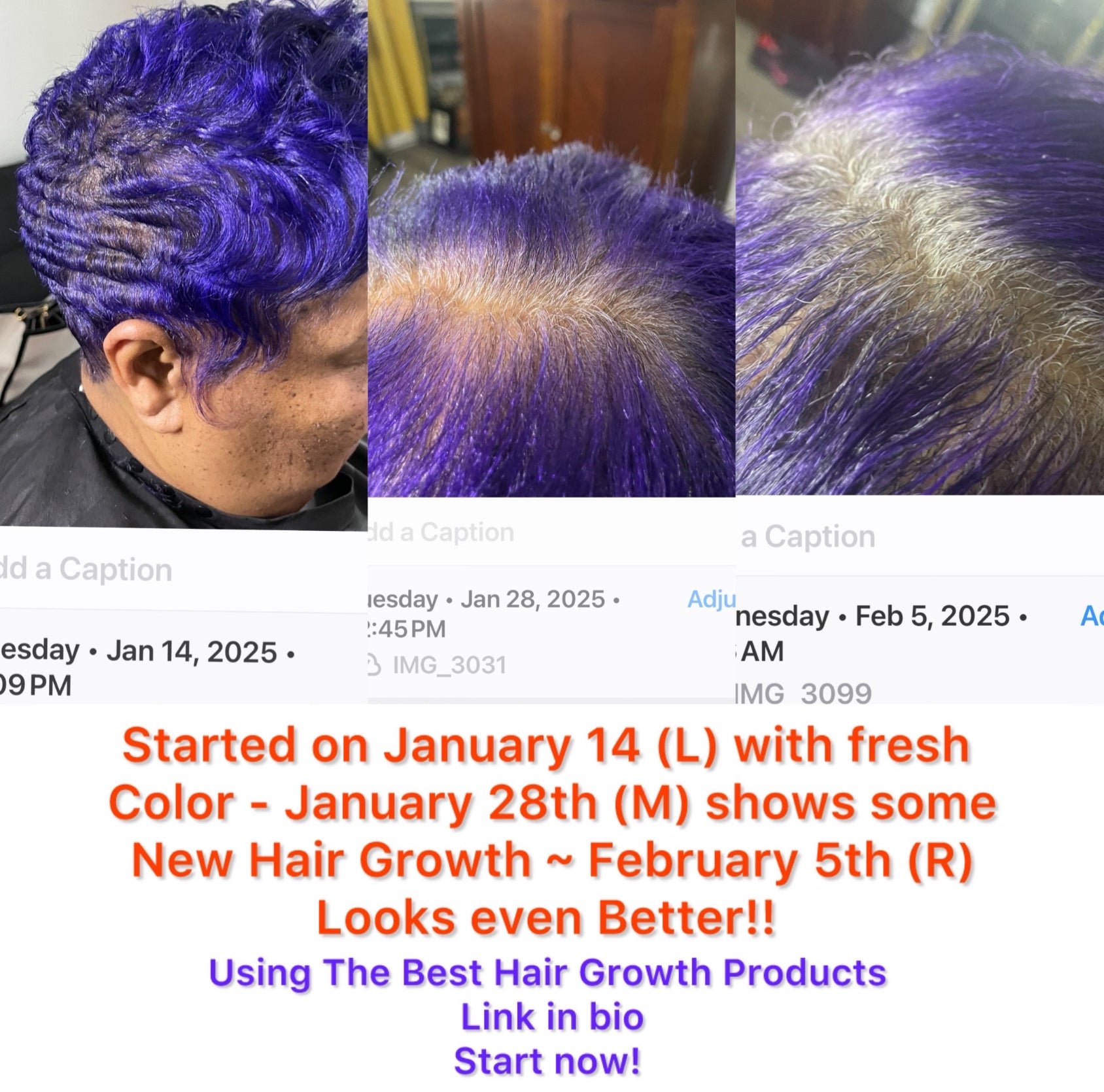Best Hair Growth Combo image 5